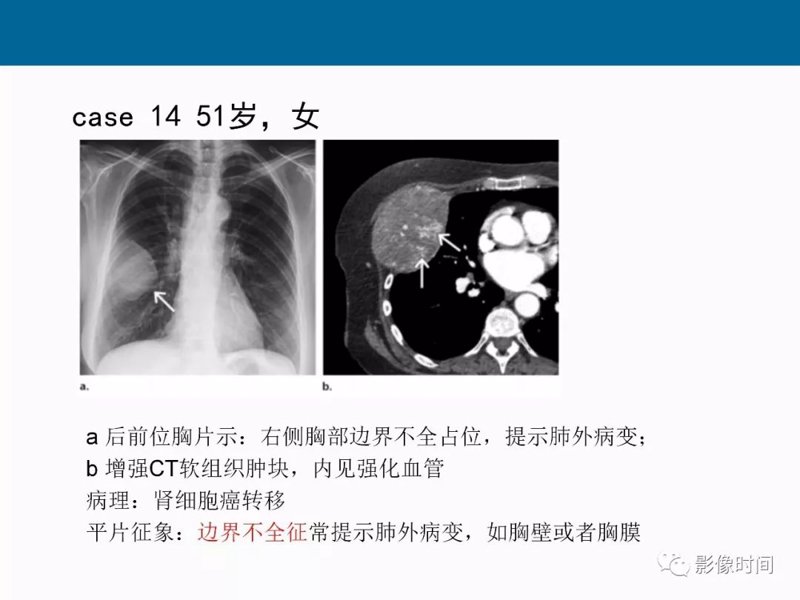 寻找软件设计工作室：如何选择与合作